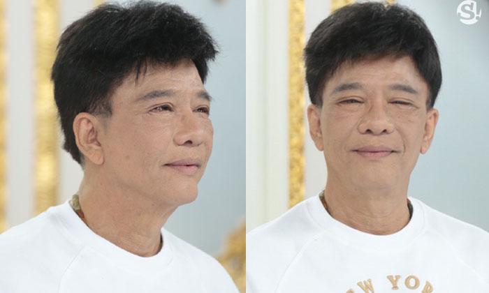 "สุรชัย สมบัติเจริญ" เบรกความแก่ เผยโฉมวัย 63 กับศัลยกรรมรอบ 2 เล็งทำเพิ่มอีก