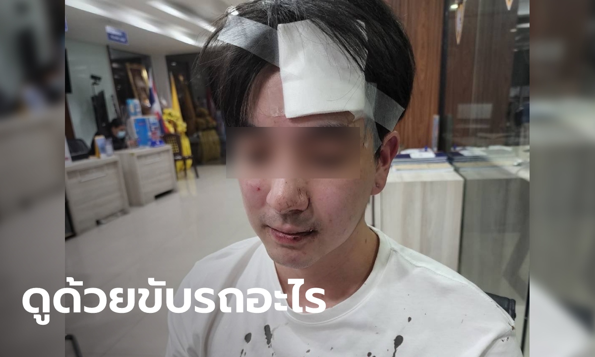 หนุ่มถูกรุมทำร้าย-ขวดฟาดหัว แจ้งความคดีไม่คืบ แถมโดนขู่ "ดูด้วยขับรถอะไร"