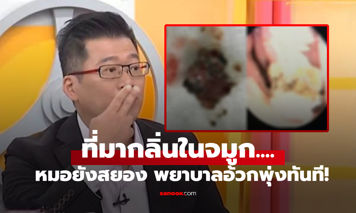 หมอลืมไม่ลง คนไข้จมูกเหม็นเหมือน \