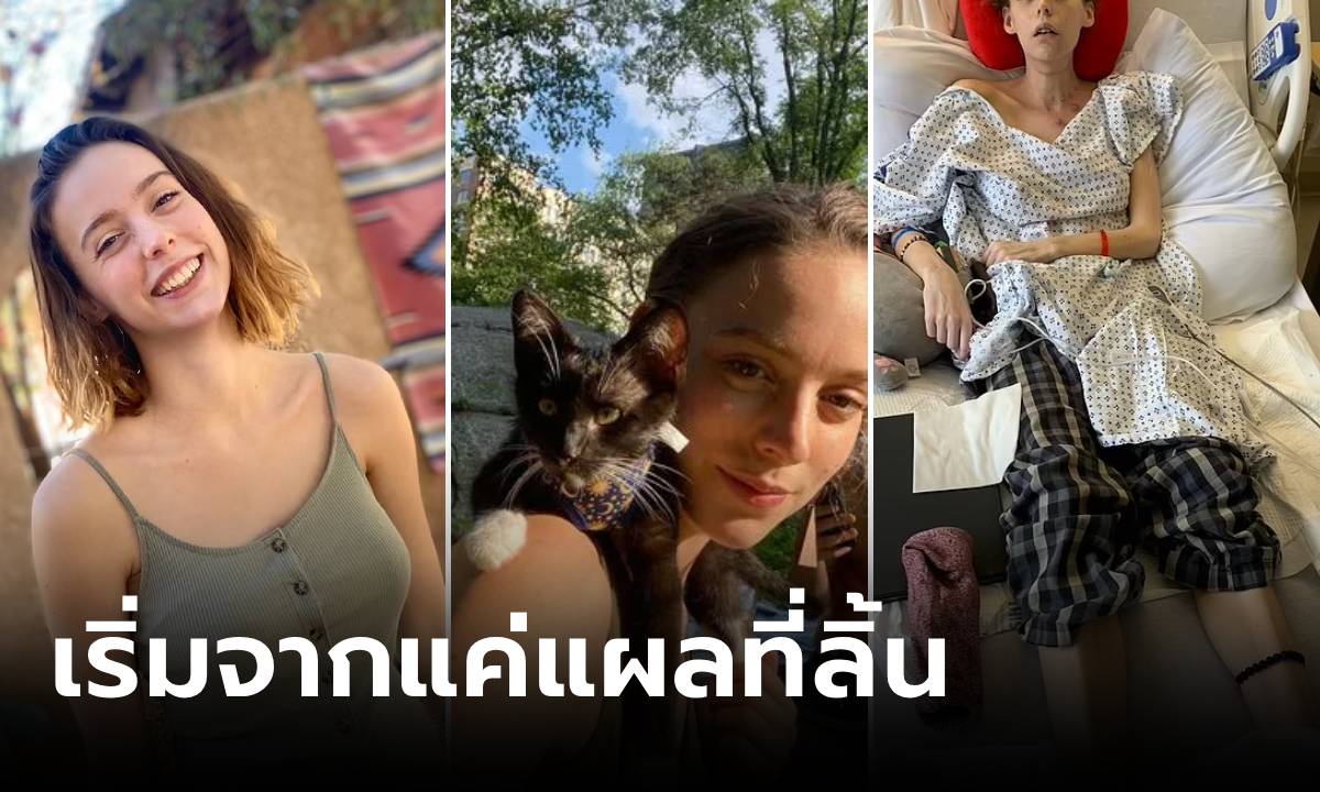 สาวอายุแค่ 24 เสียชีวิตหลังพบ "แผลที่ลิ้น" ที่แท้ป่วยโรคร้าย ทรมานจนร้องขอความตาย