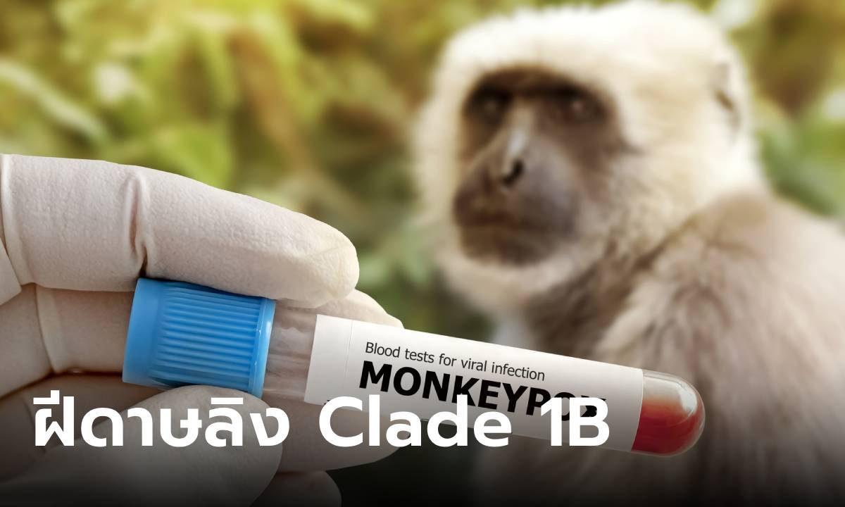 “ฝีดาษลิง Clade 1B” สายพันธุ์ใหม่ เชื้อแพร่ง่าย อันตราย ป้องกันอย่างไร?