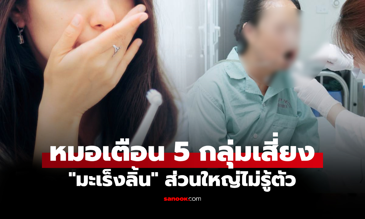 มะเร็งลิ้น แพทย์เตือนคน 5 กลุ่ม \
