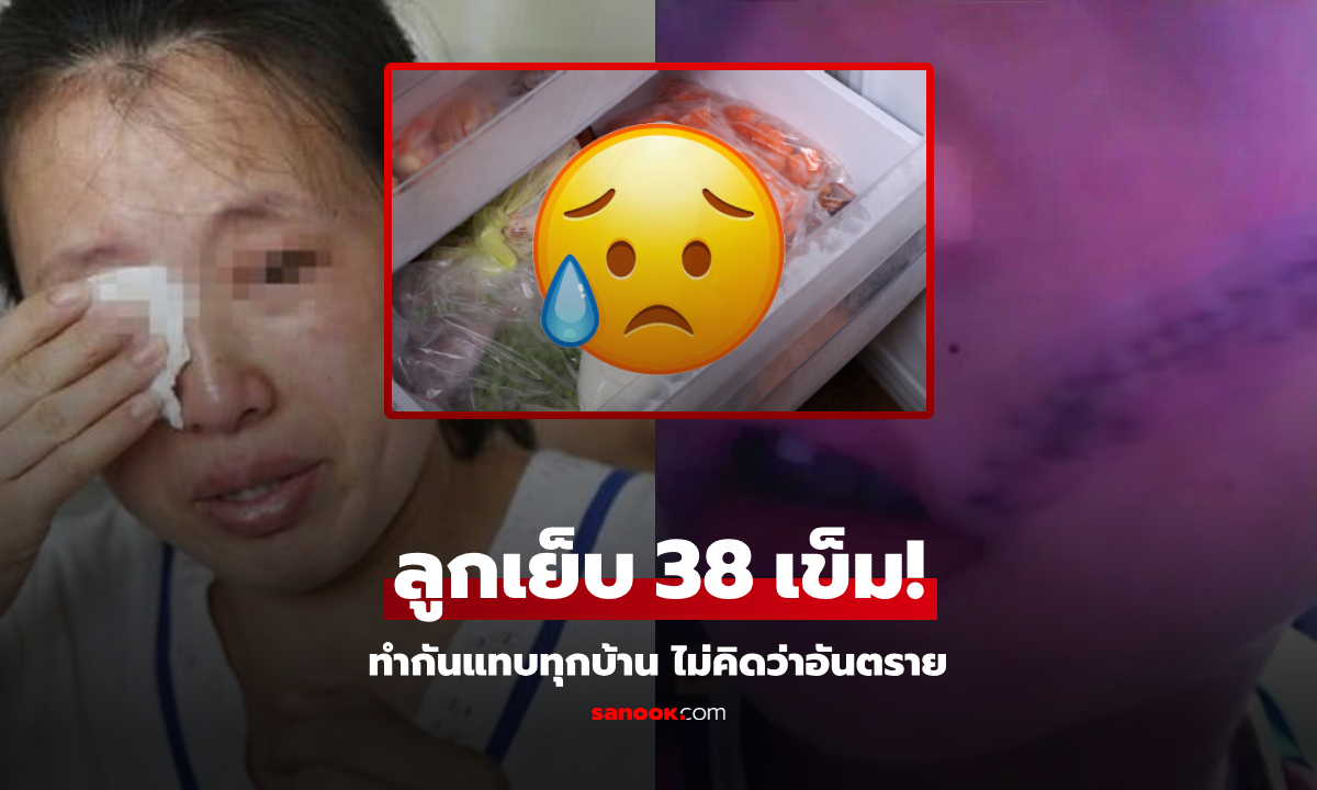 ลูกชายร้องลั่น เย็บหน้า 38 เข็ม แค่เพราะหยิบ \