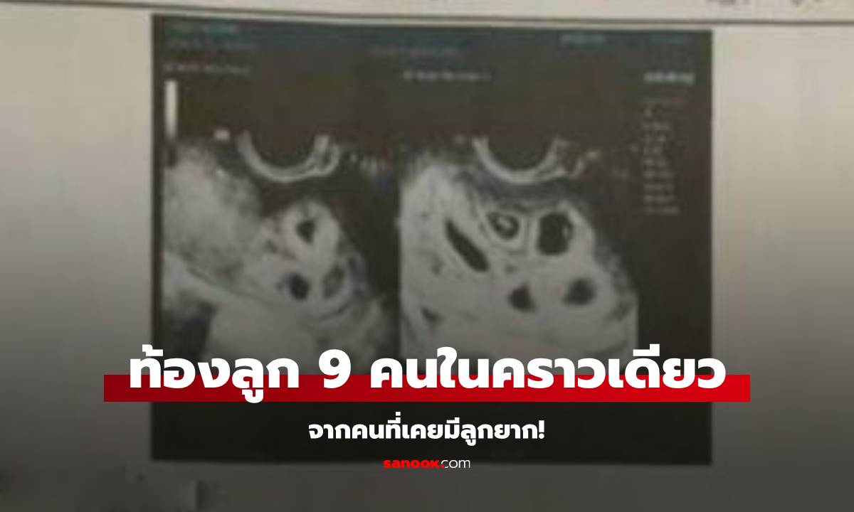 หญิงวัย 25 มีลูกยาก พอปรึกษาแพทย์และใช้ยา ผ่านไป 1 เดือน เธอท้องลูก 9 คน!