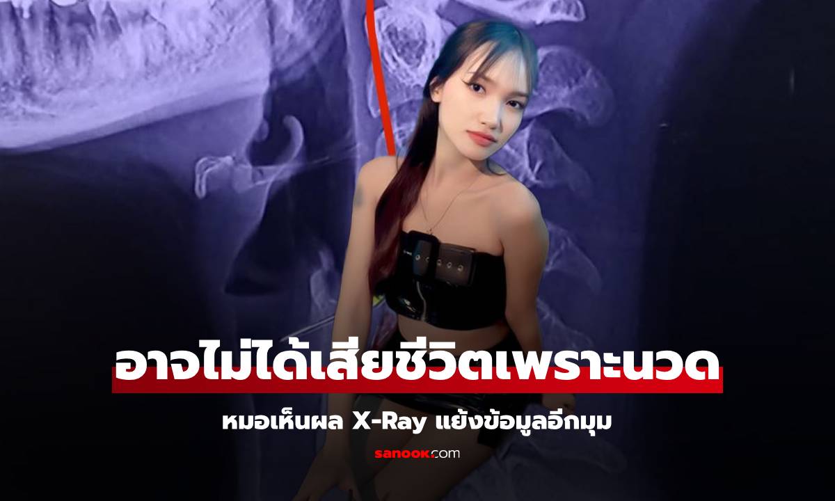 อ้าว ยังไง!? อาจารย์หมอเผย ผล X-Ray \