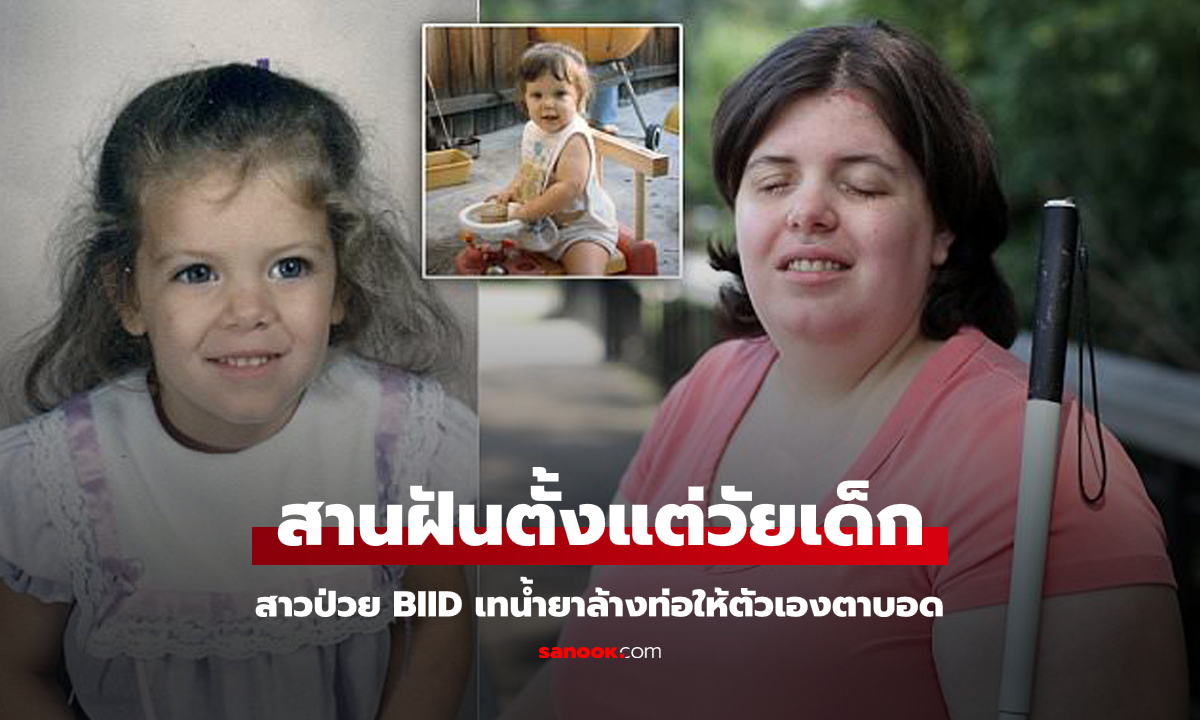 คุณอ่านไม่ผิด! สาวป่วยโรค BIID ตัดสินใจใช้น้ำยาล้างท่อเทให้ตัวเองตาบอด