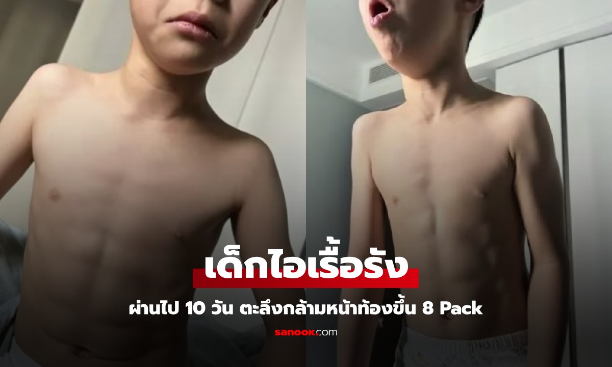 เด็กชาย 7 ขวบ ป่วยไข้หวัดใหญ่ ไอเรื้อรังนาน 10 วัน ตะลึงกล้ามหน้าท้องขึ้น 8 Pack