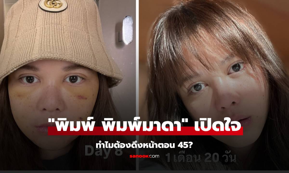 ถอดรหัสความสวยเป๊ะ! \