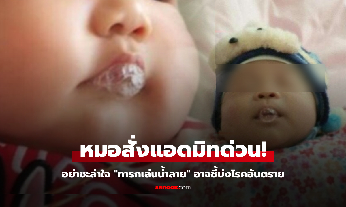 ลูกน้อย 2 เดือน ชอบเล่นน้ำลาย “เป็นฟองสบู่” แม่คิดว่าน่ารัก แต่แพทย์สั่งแอดมิทด่วน!