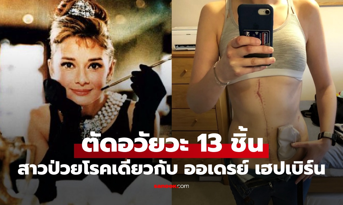 สาวป่วยโรคเดียวกับนักแสดงดัง ตัดอวัยวะทิ้งแล้ว 13 ชิ้น หมอยังมีข่าวร้ายกว่านั้น