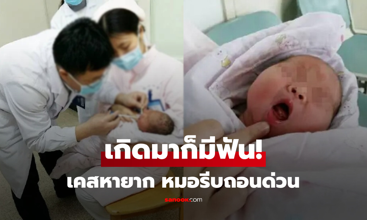 ไม่ใช่ฟันน้ำนม! ทารกคลอดมา \