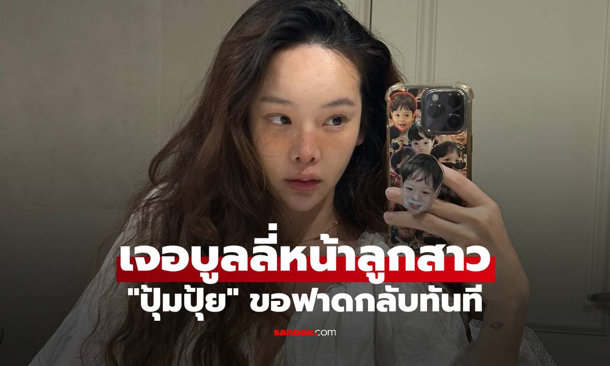 \