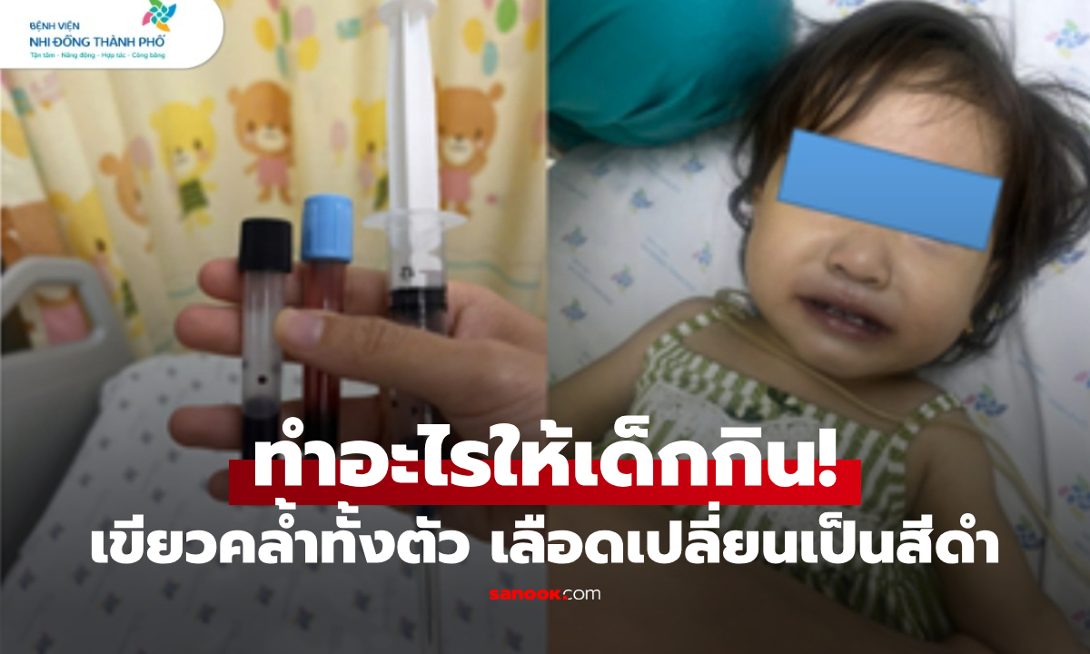 ช็อกทั้งบ้าน! ลูกสาว 1 ขวบ ตัวเขียว-เลือดดำ หลังกิน \