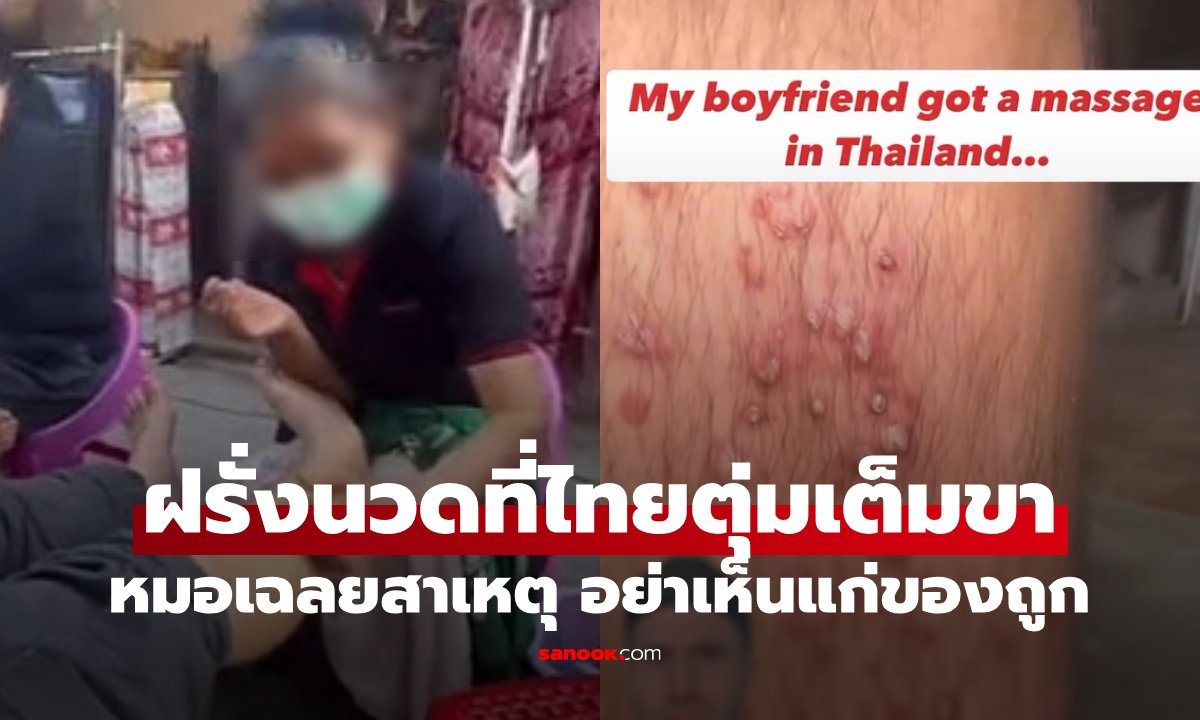 ฝรั่งนวดที่ไทย ตื่นมาตุ่มหนองเต็มขา หมอเฉลยสาเหตุ นวด 5 ดอลลาร์ ติดเชื้อฟรี!