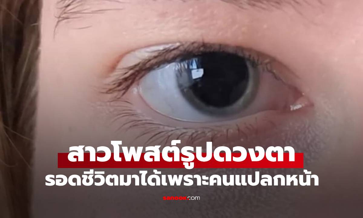 สาวโพสต์รูปดวงตา คนแปลกหน้าทักจนรอดชีวิตหวุดหวิด ไม่งั้นคืนนั้นอาจไม่ตื่น