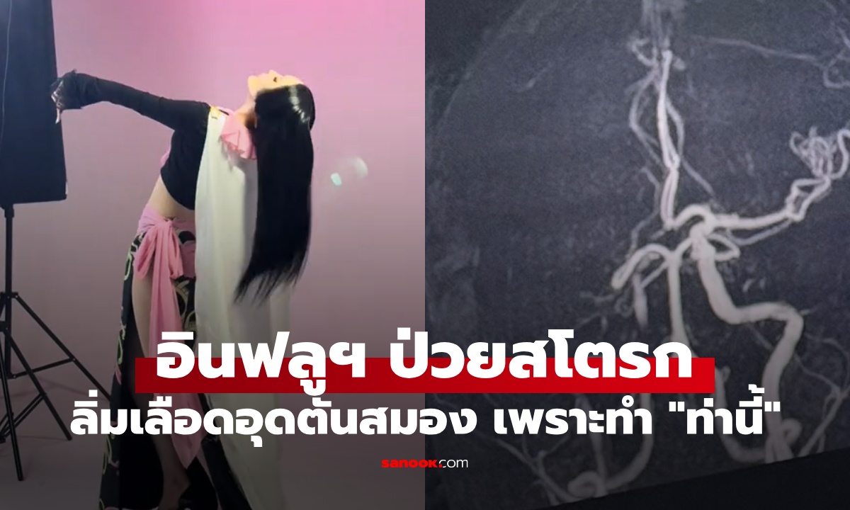 อินฟลูฯ สาววัย 32 ป่วยสโตรก ลิ่มเลือดอุดตันสมอง หลังถ่ายคอนเทนต์แล้วทำ "ท่านี้"
