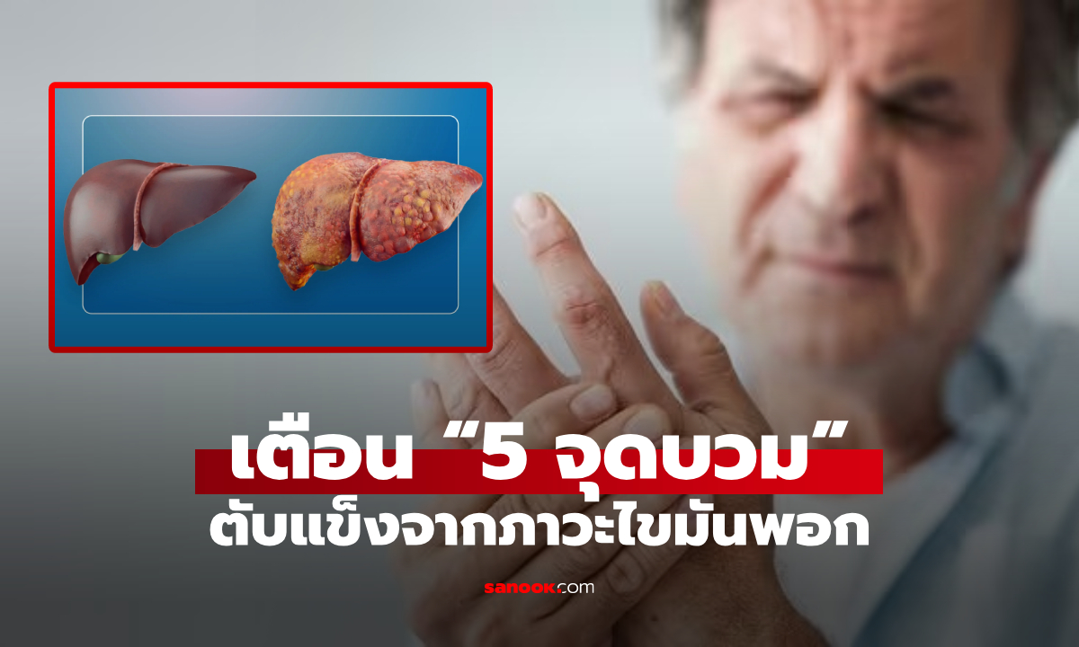 เมื่อไขมัน “บุกรุก” ทำลายตับ ร่างกายจะบวม 5 จุด เตือนมีแค่ 1 จุด ก็ควรรีบพบแพทย์!