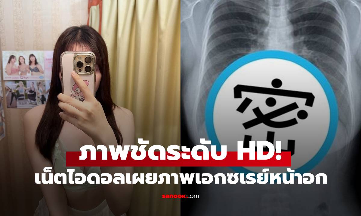 ชัดระดับ HD! เน็ตไอดอลสาวโพสต์ภาพเอกซเรย์หน้าอก แต่คนหลุดโฟกัส 2 จุด