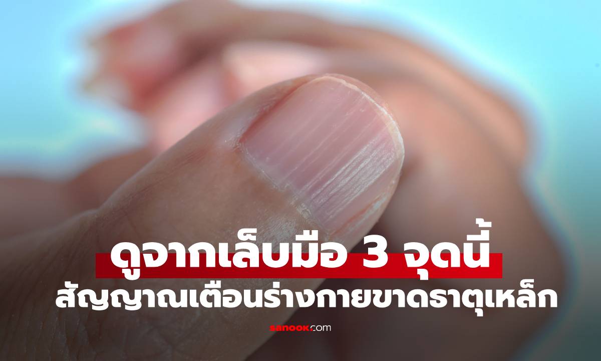 รีบเช็กด่วน! คนที่ขาดธาตุเหล็ก ดูจาก \
