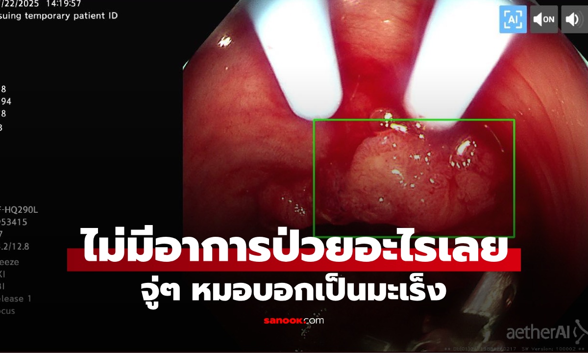 หนุ่มวัย 28 ไม่มีอาการป่วย ช็อกตรวจเจอมะเร็ง หมอเตือน 1 สิ่งสำคัญที่ทุกคน \