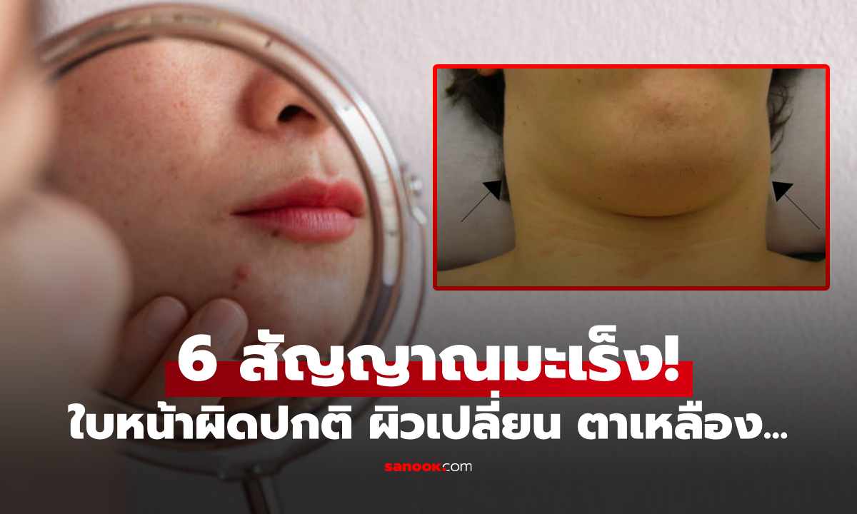 เผย 6 สัญญาณร้าย บ่งชี้ \