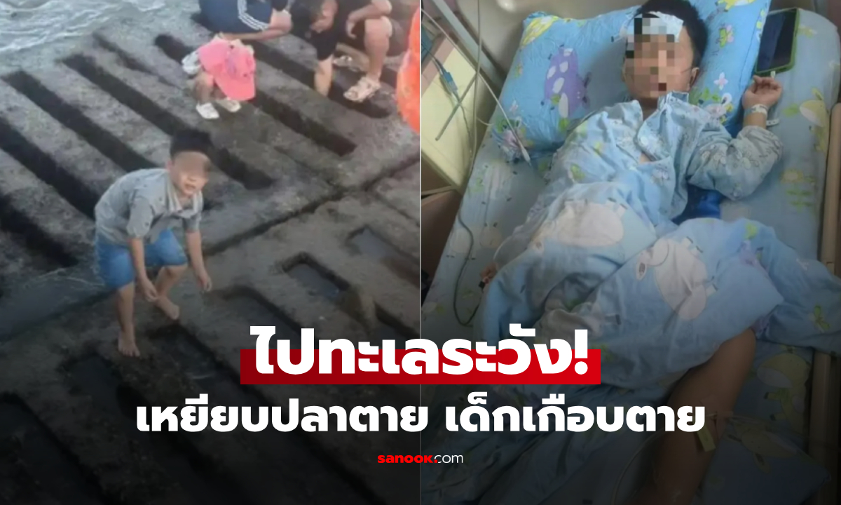 ช็อก! ลูก 6 ขวบเกือบตาย เพราะเหยียบปลาตาย ติดเชื้อสยอง \