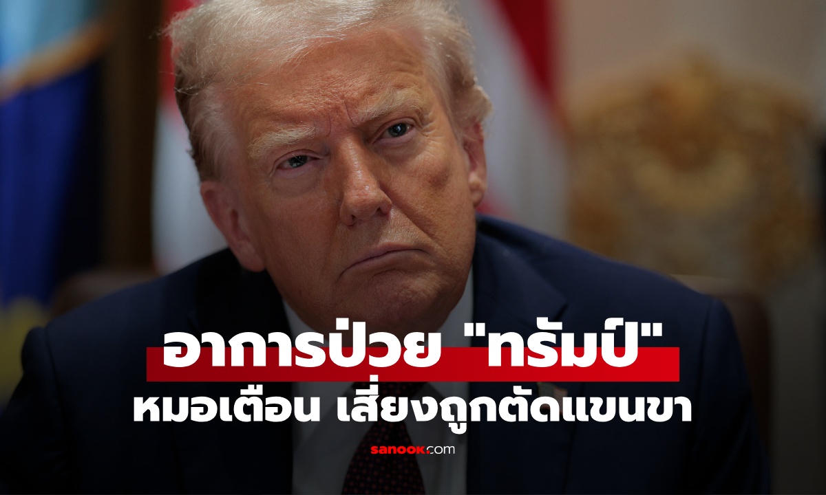 หมอเฉพาะทางเตือน อาการป่วย \