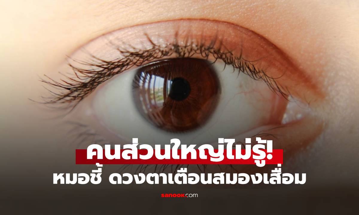 หมอเตือน 4 อาการดวงตา บ่งชี้ \