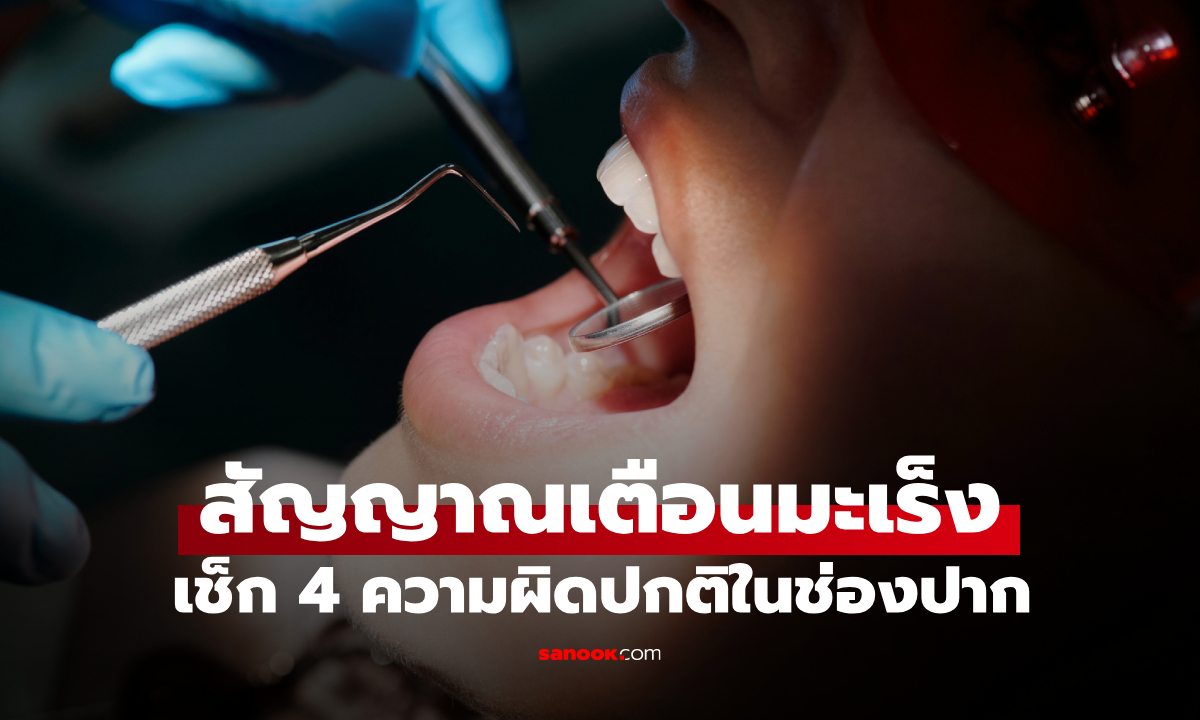 4 ความผิดปกติในช่องปาก สัญญาณเตือนล่วงหน้าเมื่อมะเร็งเลือกคุณเป็น \