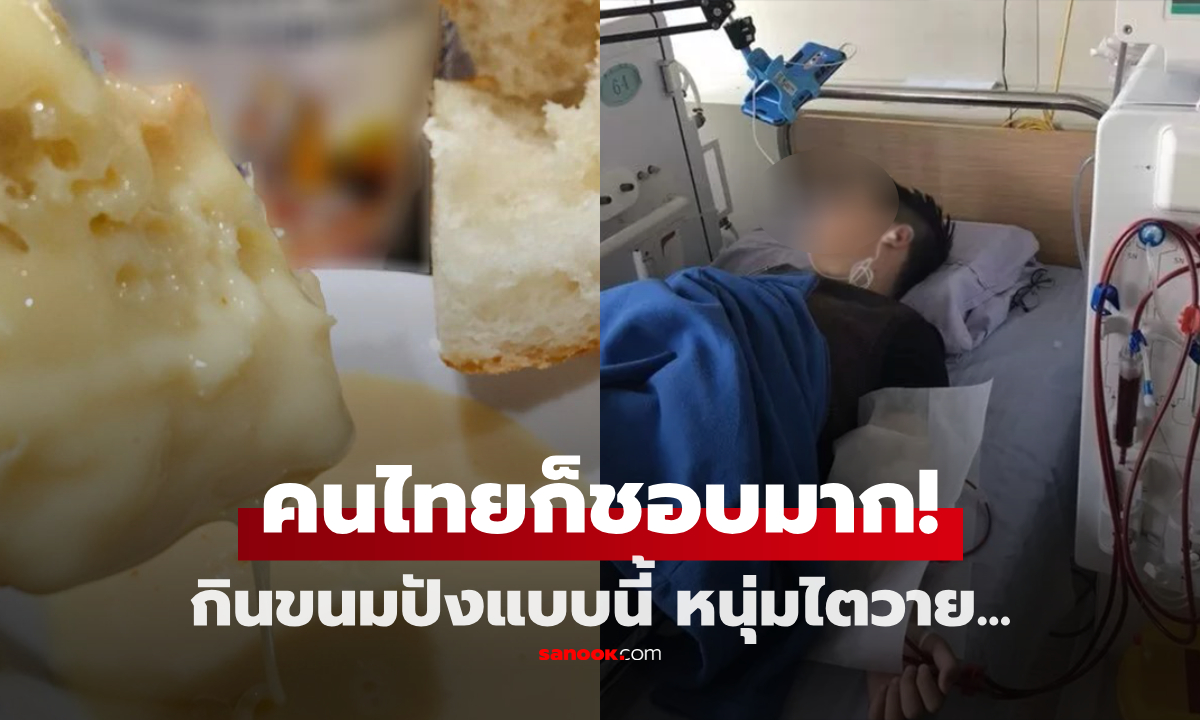 ช็อก หนุ่มจีนวัย 20 ฟอกไตตลอดชีวิต เพราะขนมปัง \
