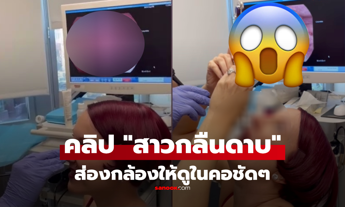 สุดช็อก! สาวกลืนดาบยาว 46 ซม. พิสูจน์ชัดๆ ด้วยคลิปส่องกล้อง \