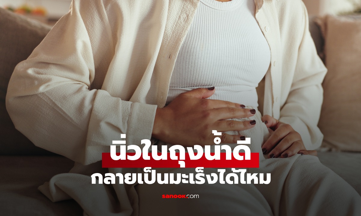 นิ่วในถุงน้ำดี กลายเป็นมะเร็งได้ไหม? สังเกต 4 สัญญาณเตือนที่ไม่ควรมองข้าม