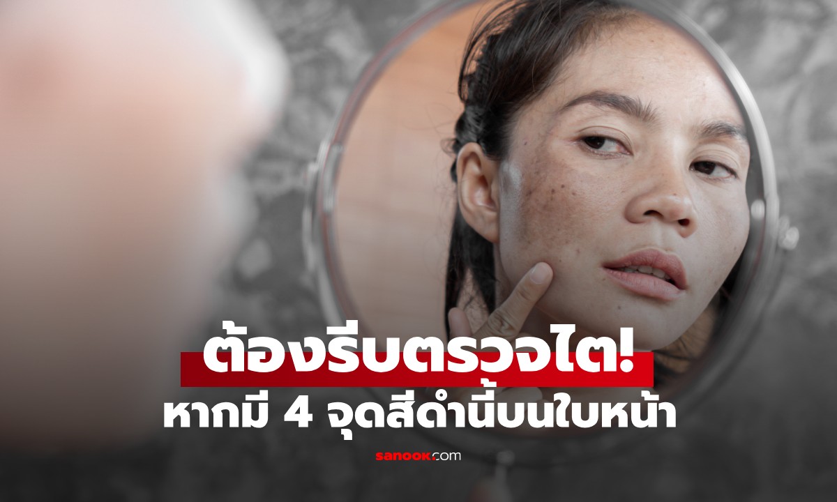 หากมี 4 จุดสีดำนี้บนใบหน้า ต้องรีบตรวจไต! สัญญาณร้ายแรงที่สุดอาจเป็น \