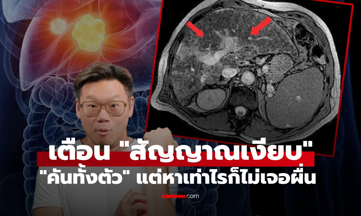 หมอเจด เตือน \