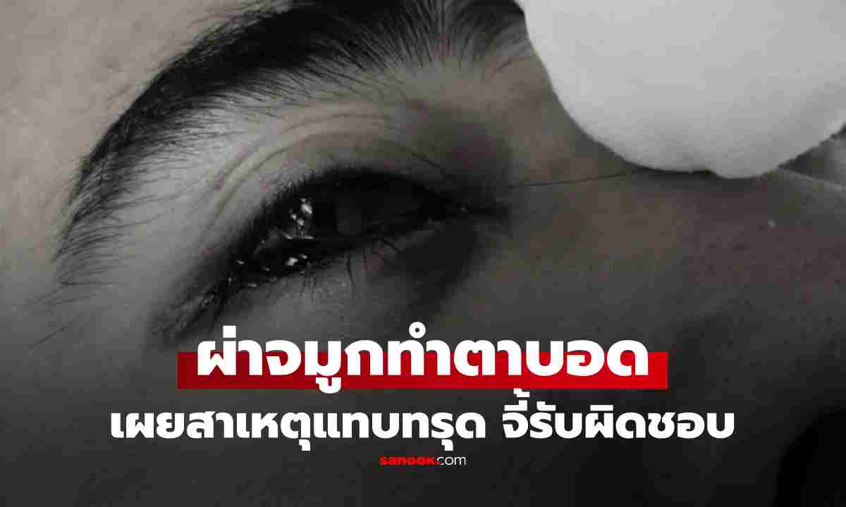 หนุ่มผ่าตัด \