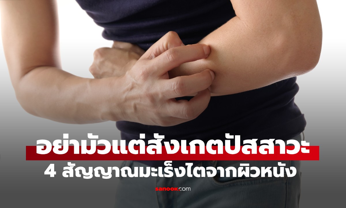 หมอเตือน 4 สัญญาณ \