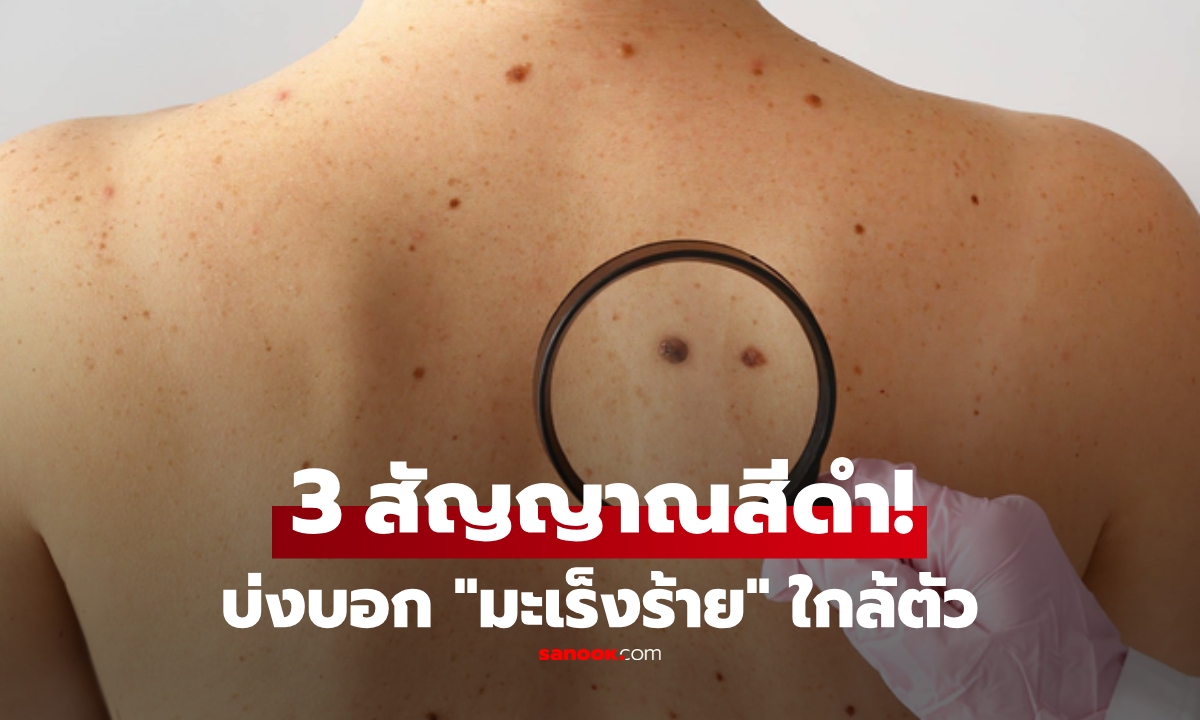 ไม่ใช่แค่ไฝ! เผยครบ \