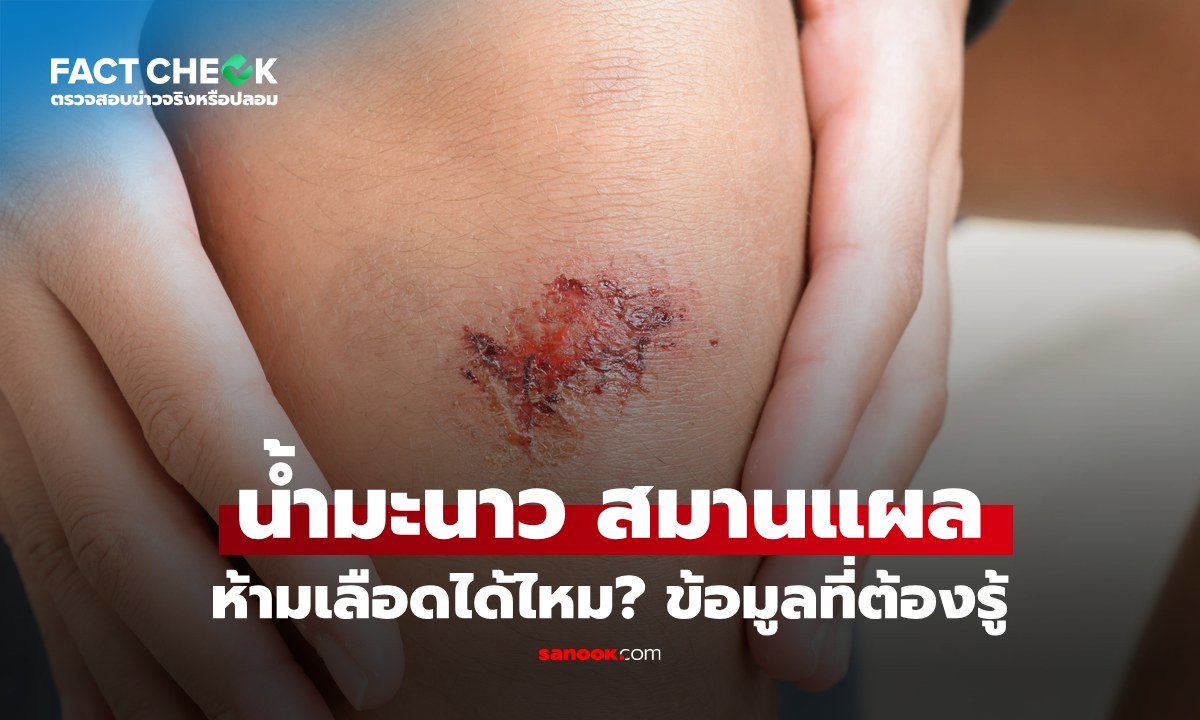 เช็กข่าวชัวร์ : น้ำมะนาว ช่วยสมานแผล ห้ามเลือดได้ไหม? ข้อมูลที่ต้องรู้