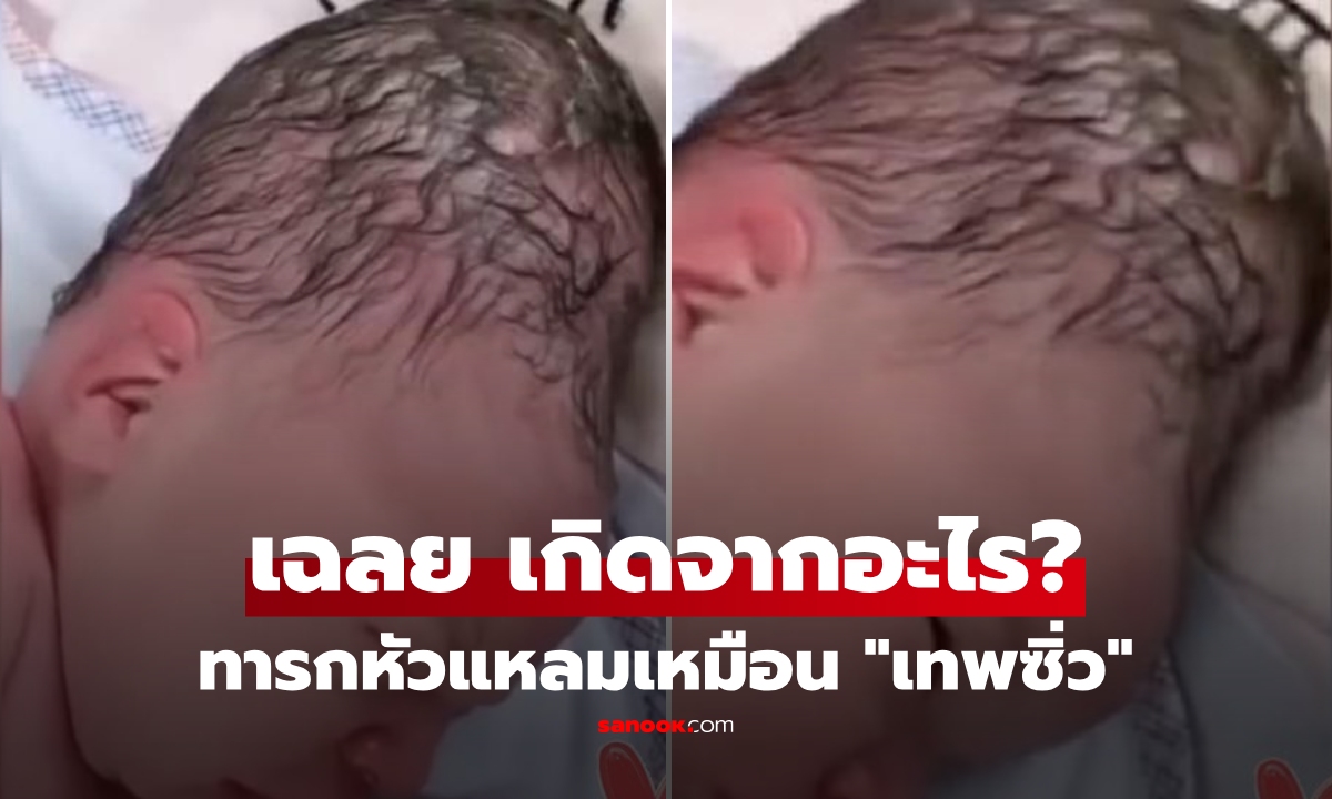 สมองเบี้ยว?! แม่ใจหล่นวูบ ลูกคลอดมา \