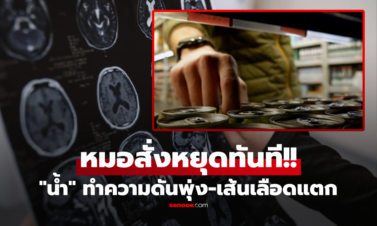 ชายแข็งแรง ไม่เหล้า-บุหรี่ จู่ๆ เส้นเลือดสมองแตก แพทย์รู้ \
