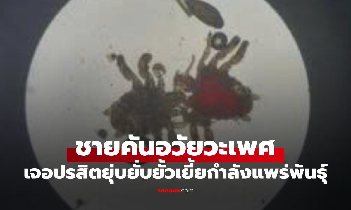 ชายคันเป้าเป็นปี หมอส่องกล้องเจอ \