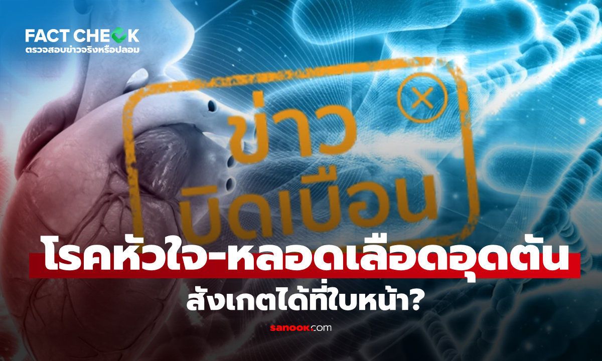 เช็กข่าวชัวร์ : โรคหัวใจ-หลอดเลือดอุดตัน สังเกตได้ที่บนใบหน้า