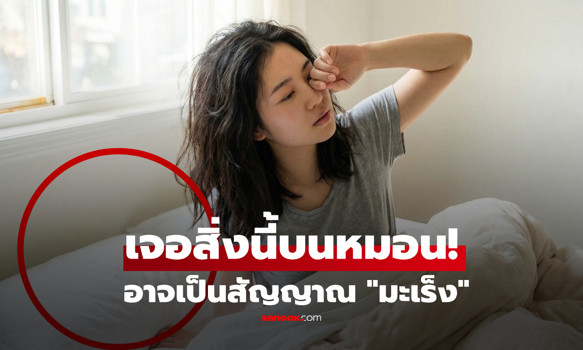 สัญญาณมรณะบน \