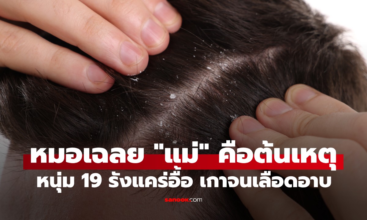 หนุ่ม 19 รังแคร่วงกราว เกาหัวจนเลือดอาบหมอน หมอเฉลย \