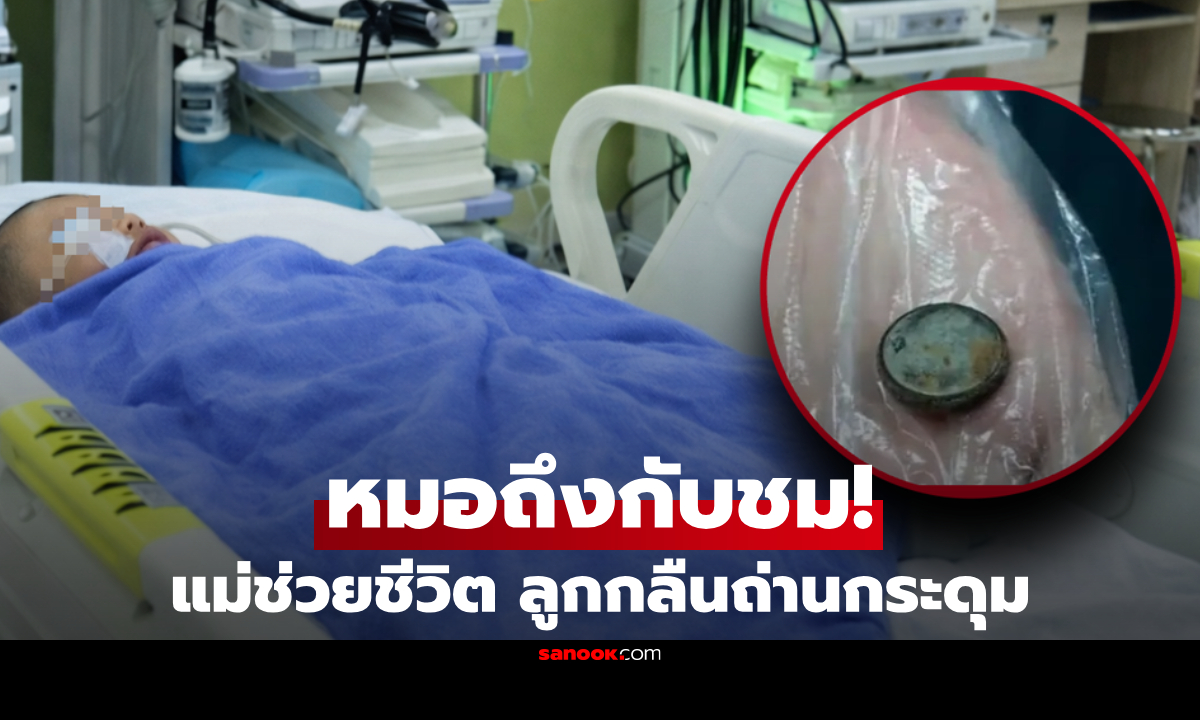 ชื่นชมแม่! ลูกน้อย 3 ขวบ กลืนถ่านกระดุม รีบให้กิน "สิ่งนี้" ตามไป 1 ช้อน ก่อนอุ้มส่งหมอ