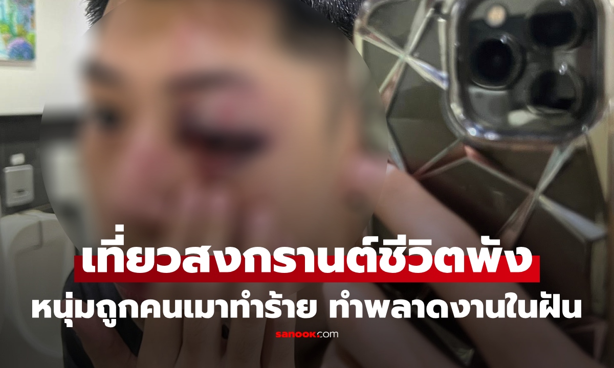 เที่ยวสงกรานต์ครั้งเดียว ชีวิตพัง! หนุ่มร่ำไห้ เล่าถูกคนเมาต่อยตาแตก เจ็บกว่ากาย คือพลาดงานในฝัน