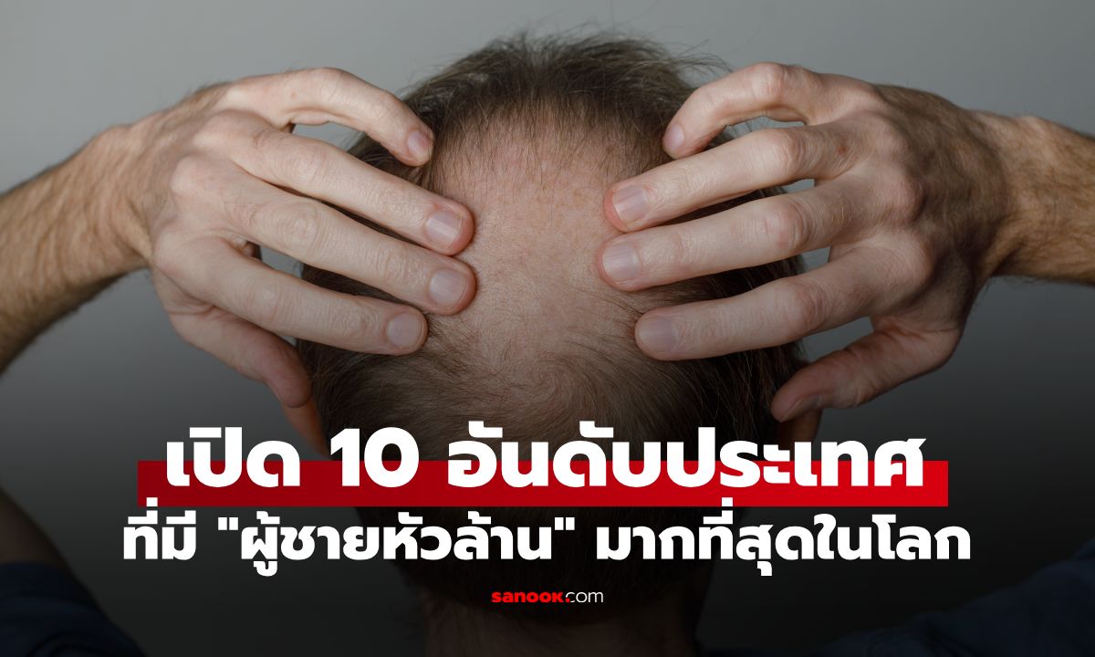 10 ประเทศที่มี "ผู้ชายหัวล้าน" มากที่สุดในโลกปี 2026 ไทยอยู่อันดับไหน?