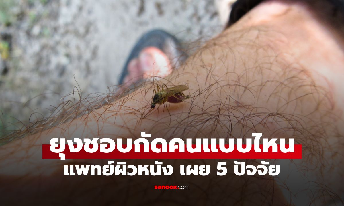 ทำไมบางคนถึงกลายเป็น "เครื่องดักยุงเคลื่อนที่" แพทย์ผิวหนัง เผย 5 เหตุผล