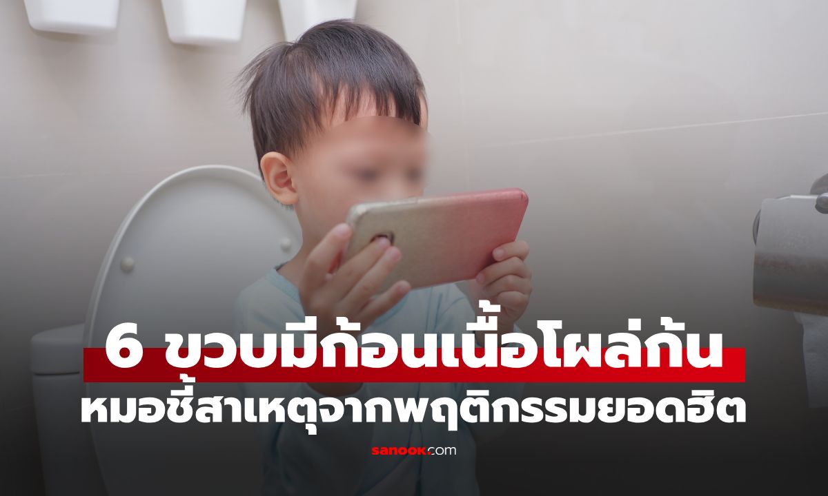 แม่แทบช็อก! ลูกชาย 6 ขวบ มี "ก้อนเนื้อ" โผล่จากก้น หมอเฉลยต้นเหตุจากนิสัยยอดฮิต