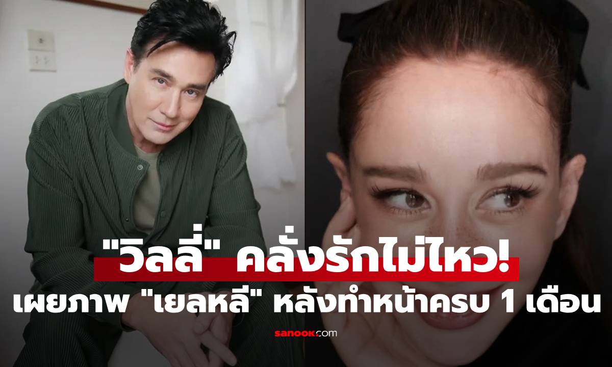 "วิลลี่" คลั่งรักไม่ไหว! เผยภาพ "เยลหลี" หลังทำหน้าครบ 1 เดือน ลั่นเหมือนได้ภรรยาใหม่